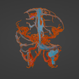 uv7.png 3D Model of Brain Arteriovenous Malformation
