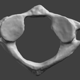 3.png Human Atlas Vertebra (C1)