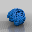 ab3a1853ec5300782920ffb7f03e0ce6.png Mon cerveau ; scanné à partir d'une IRM