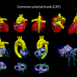 4.CAT.png Congenital Heart Disease - 7pack