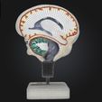 2.jpg 3D Model of Cerebrospinal Fluid Brain