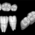 Lower-3-Pic.png Lower Dental Anatomy Study Model -  Updated: Added HD Buccal Sculpt