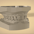 Screenshot_19.png Digital Orthodontic Study Models with Virtual Bases