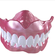 12.png Digital Full Dentures with Combined Glue-in Teeth Arch