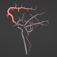 13.png 3D Model of Brain and Blood Supply - Circle of Willis