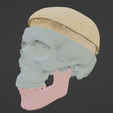 7.png 3D Model of Skull, Skull Cap and Mandible