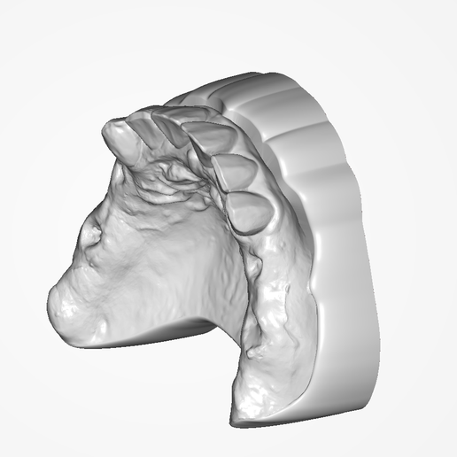 Screenshot_5.png Digital RPD Model