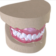 6.png Digital Full Dentures with Combined Glue-in Teeth Arch