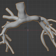 6.png 3D Model of Pulmonary Arteries (Fontan Procedure)