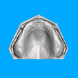 Captura-de-tela-2022-09-09-114048.png Edentulous Models - Meshmixer.