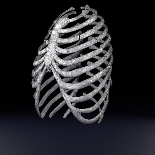 STL file Rib fracture and its types 🦴 ・Design to download and 3D print ...