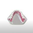 10.png Digital Single Jaw Full Denture