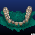Screenshot_4.png Phantom dental model for dental technicians