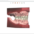 Screenshot_8.png Digital Try-in Full Dentures for Injection Molding