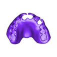 789513050_20241208_1118_Tech_01__0_Print.stl DIGITAL FLEXIBLE UPPER PARTIAL DENTURE  (3D models !!!) - 7 stl files for download)