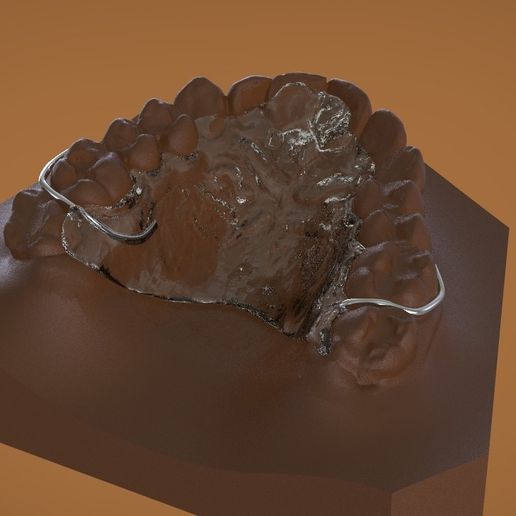 Digital Ortho DTI Deprogrammer Appliance