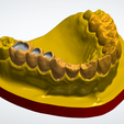 2.png Restorative model for dental students