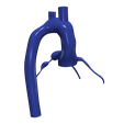 6.png 3D Model of Aorta and Coronary Arteries