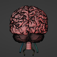 32.png 3D Model of Brain and Aneurysm