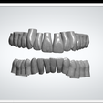 File View Help Vertices: 314653 Facets: 629187 3shape> \S en 18q library of teeth