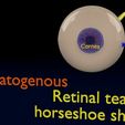 retinal-detachment-types-eye-3d-model-blend-90.jpg Retinal detachment types eye 3D model