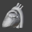 Screenshot-2024-11-25-133421.jpg 有心房间隔缺损的心脏 3D 模型
