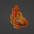 uv1.png 3D Model of Heart with Atrial Septal Defect