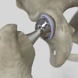 Image3.jpg Hip Replacement model