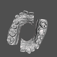 Dental-Training-1.png Training Teeth for Dental Students Black Dental Caries Classification