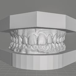 moei-cults.jpg STL-Datei Dental Orthodontic Study Model with Bases・3D-Druck-Idee zum Herunterladen