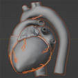 12.png 3D Heart Anatomy with Codominance