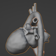 29.png 3D Model of Heart after Fontan Procedure