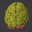21.png 3D Model of Skull and Brain with Brain Stem