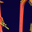 PS0067.jpg Human arterial system schematic 3D