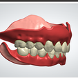 23.png Digital Full Dentures with Combined Glue-in Teeth Arch