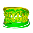 modelPreview.png Telescopic crowns 0D 13, 12, 11, 21, 22