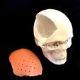 IMG_0099.JPG Craniofacial Implant 3d  print model