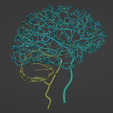 20.png 3D Model of Brain and Aneurysm
