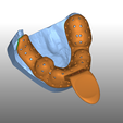PEI2.PNG Dental impression trays lower + lowerjaw model