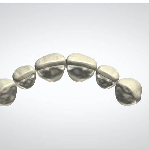 🦷 3Shape Library Upper_Natural_2・ STL File for 3D printing・Cults