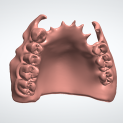 OnPaste.20231122-163633.png PARTIAL REMOVABLE DENTURE (Upper) - 4 stl files : Base + teeth + teeth + monoblock