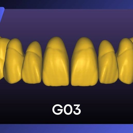 🦷 V.I.P Collection For exocad ( Vip tooth library over 400