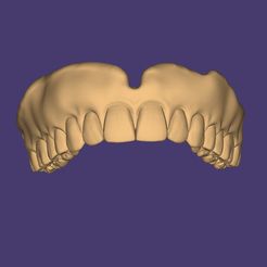 Clipboard-2024-06-11-19-19-04.jpg DIGITAL TOTAL and PARTIAL REMOVABLE DENTURES - 9 stl files