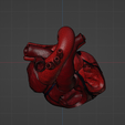 w1.png 3D Model of Heart with Atrial Septal Defect