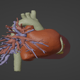 3.png 3D Model of Healthy Human Heart - generated from real patient