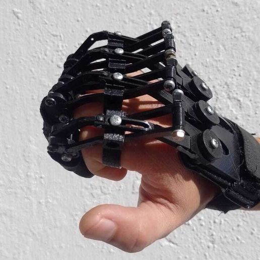 WhatsApp-Image-2025-08-23-at-2.13.33-PM-6.jpeg prothèse d'amputation proximale