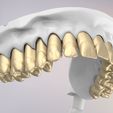 31.jpg 3D Dental Jaws Replica with Detachable Teeth