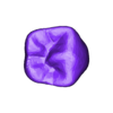 13.stl dental partial dentures