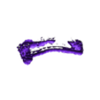 Colon diverticulitis.stl 3D Дивертикулит толстой кишки (обновлено)