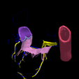 9.png 3D Model of Heart wirh Atrioventricular Septal Defect, 4 chamber view